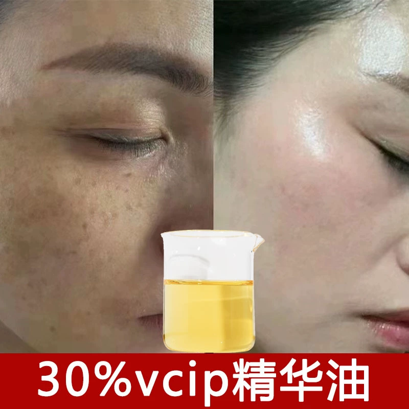30% Vcip эссенции масло для лица эфирное масло композитное растительное масло для омоложения кожи 10% Vcip эссенции косметическое масло