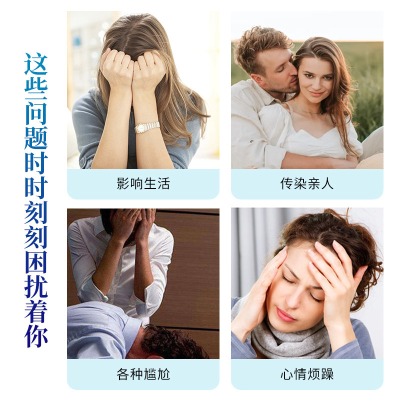 Serpiente placa cuidado de la salud crema cintura-bobinado dragón de fuego serpiente cintura-bobinado piel burbuja picazón ungüento anti-picazón crema fabricante en stock Venta caliente