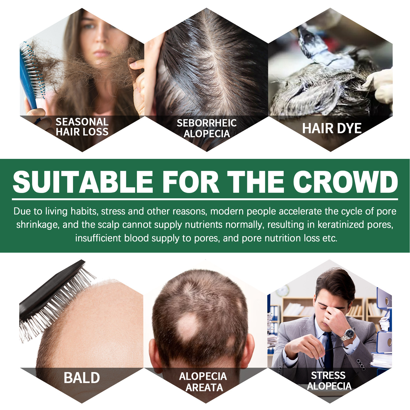 Cheveux denses East Moon pour prévenir la perte, hydratation ferme, cheveux forts et épais, massage du cuir chevelu, spray de soin capillaire_voghion.com