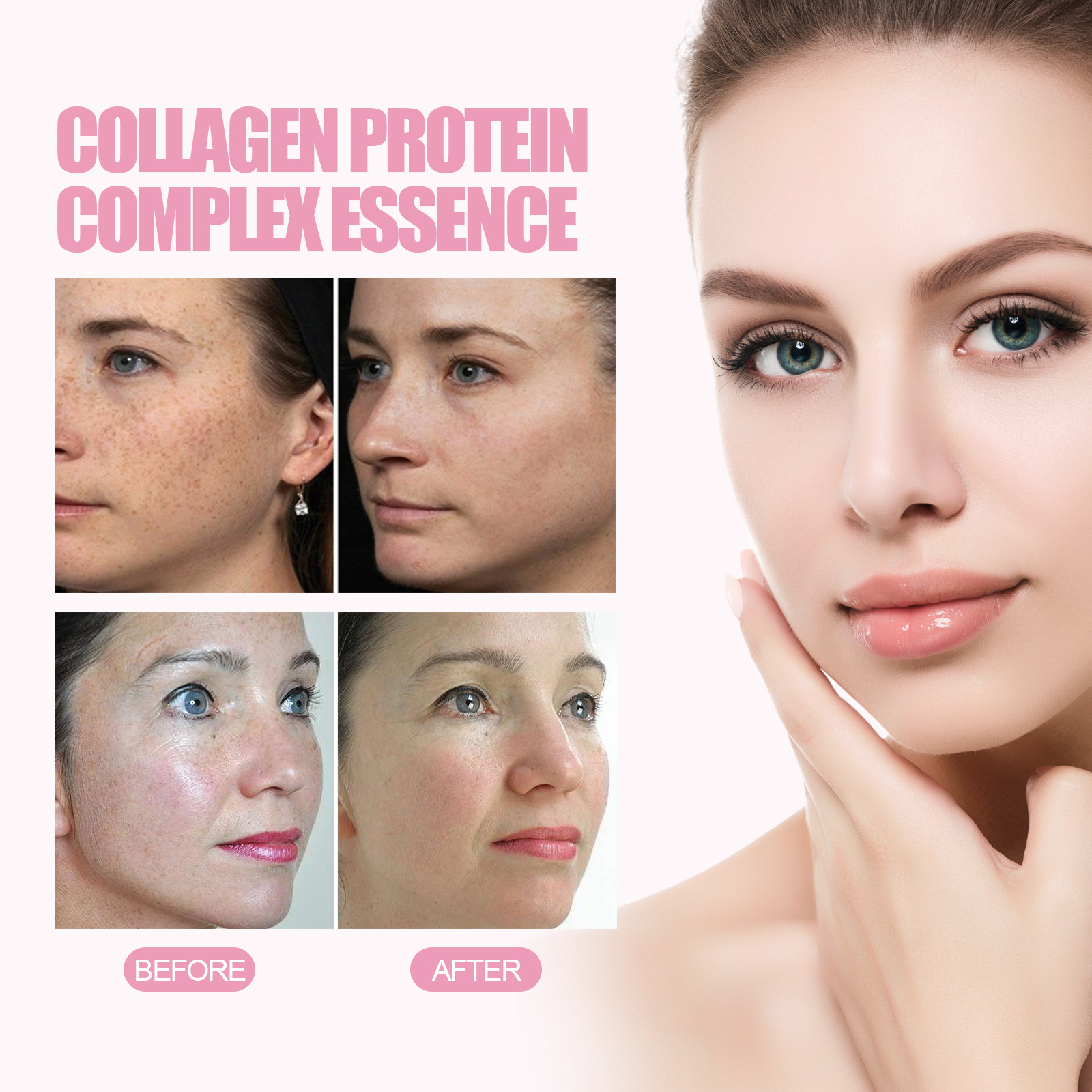 La Solution d'essence de collagène d'essence d'embryon de mouton EELHOE soulève, resserre, améliore le tonus, éclaircit les taches, hydrate et_voghion.com