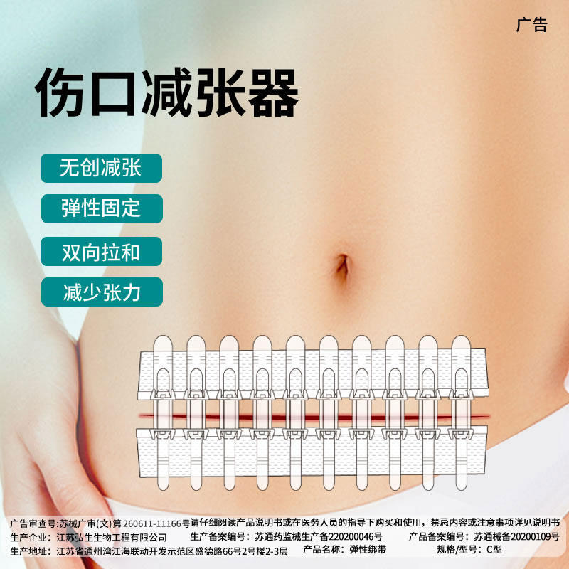 ホンシェン張力緩和器、縫合不要創傷閉鎖器、不織布ジッパー式創傷パッチ、皮膚張力緩和吻合器