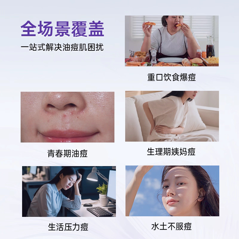 Professional Beauty Salon Line Exclusive Products Not Available Online: Anti-Acne and Acne Mark Fading Essence, Skin Care Products, Moisturizing Cosmetics, Franchise 3