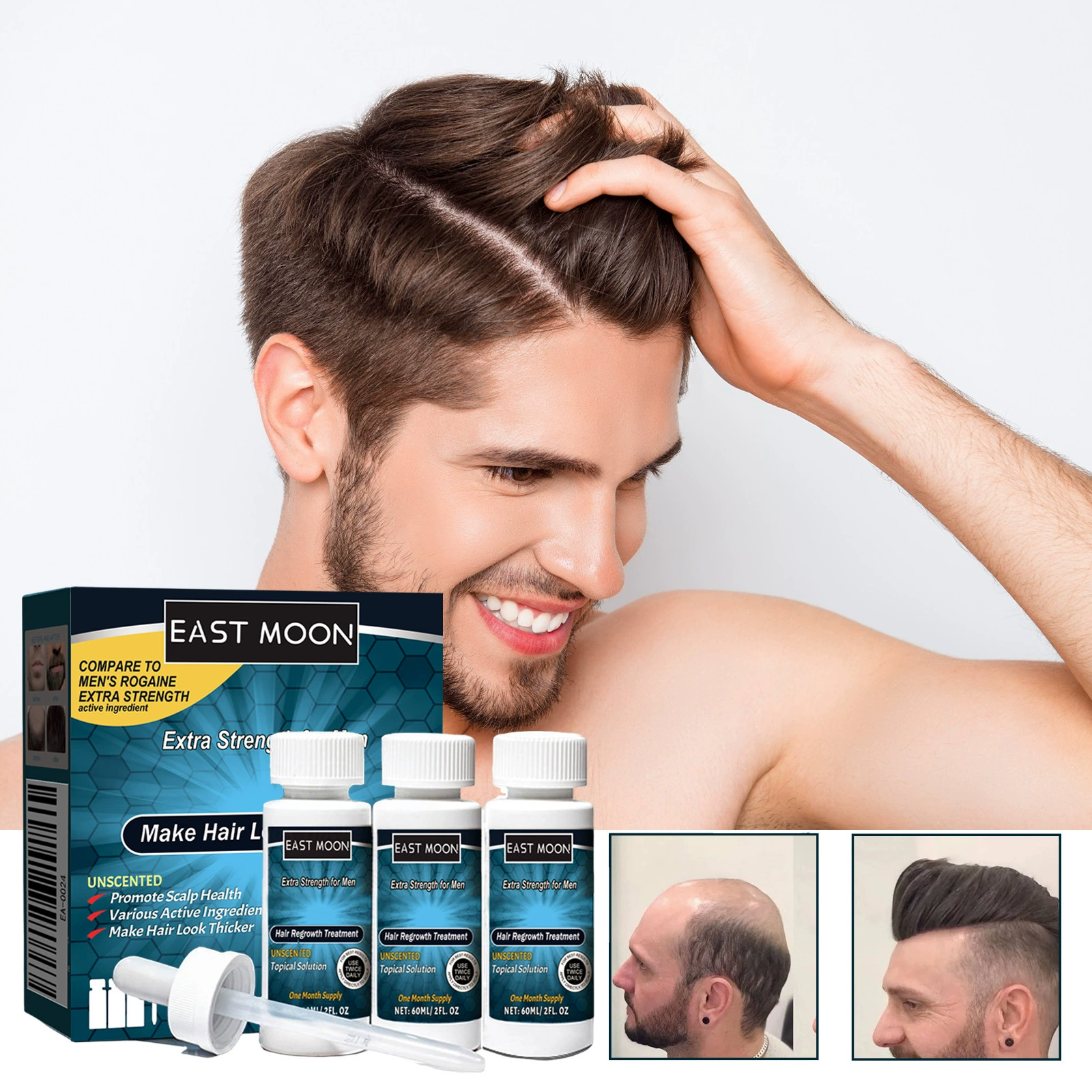 East Moon Мужской тоник для волос Мужские волосы Nutrition Care Anti-off Твердые волосы густая увлажняющая эссенция