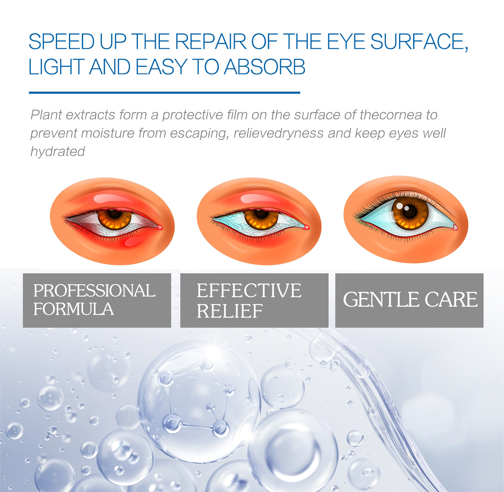 South Moon Eye Cold Compress Gel Dry Eye Itching Eyes Fatigue Blurred Eyes Improvement Eye Care Gel_voghion.com