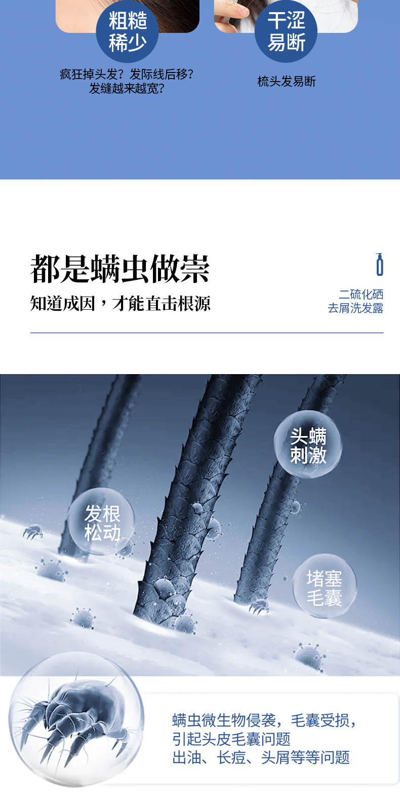 AOPY-二硫化硒去屑洗发露详情页_03.jpg