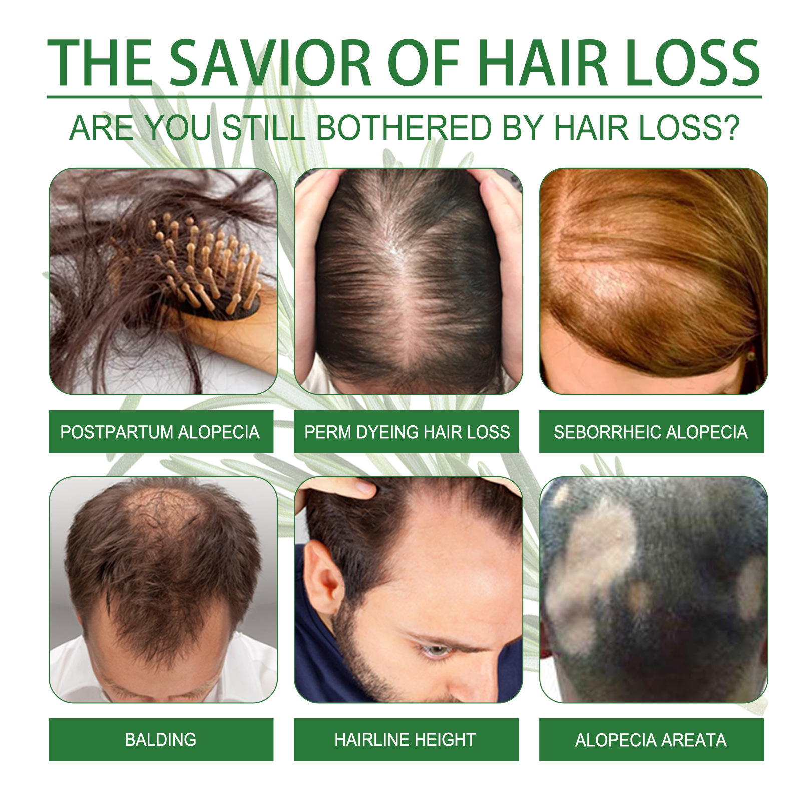 EELHOE Spray espesante para cabello con romero Hidrata las raíces del cabello, repara el cabello dañado, fortalece el cabello y previene la caída del cabello._voghion.com