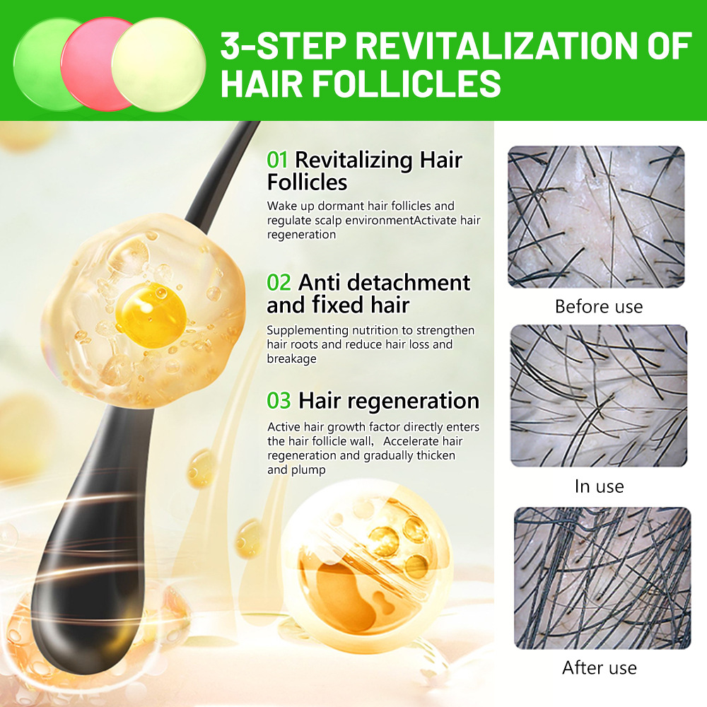 Shampoo Disaar Pflanzenhaarwachstumsseife_voghion.com