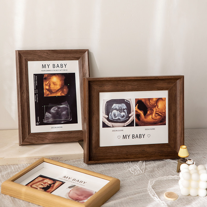 Baby 4D Photo Frame with Nt B-Ultrasound Photo Printing DIY 8inch Birth Gift Empty Frame Display Stand Baby 4D Photo Frame with Nt B-Ultrasound Photo Printing DIY 8inch Birth Gift Empty Frame Display Stand