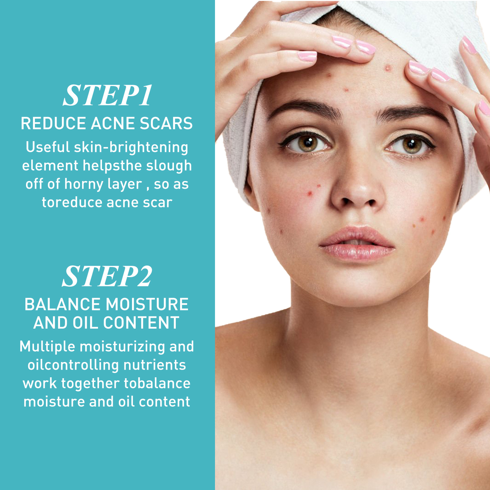 Il gel riparatore Jayusing schiarisce i segni, le macchie dell'acne, ripara, idrata e illumina la pelle_voghion.com