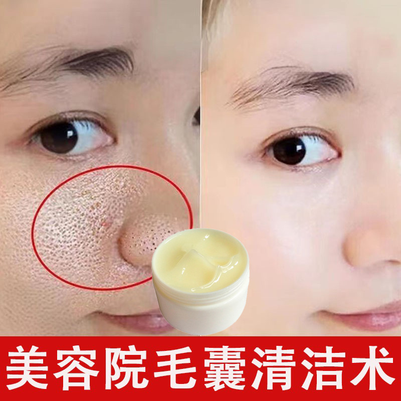 美容院毛囊净化膏毛孔清洁霜去黑头粉刺深层清洁膏面部清洁按摩膏