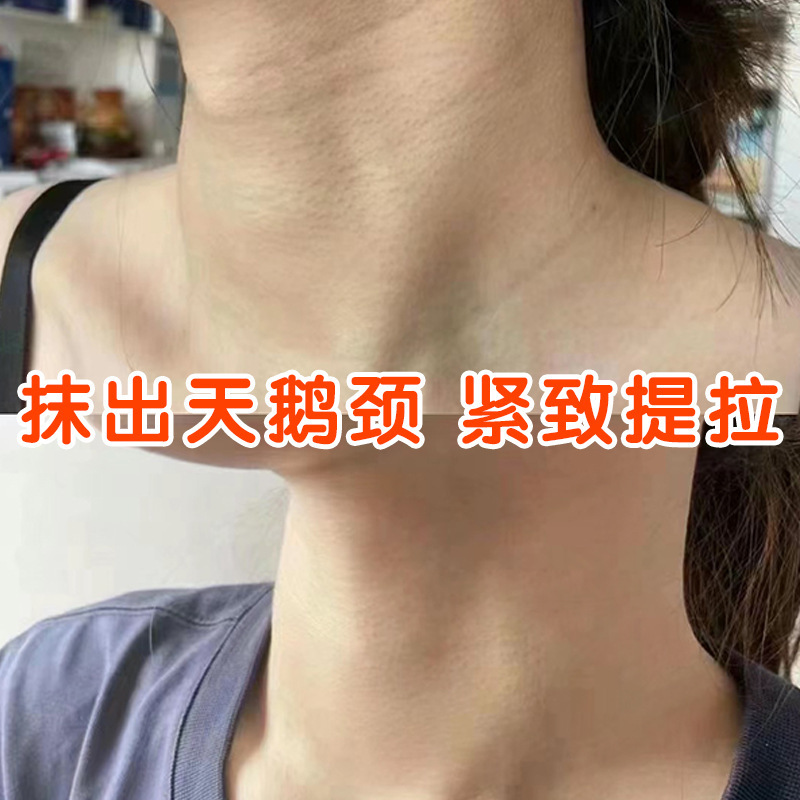 首の紋様のクリームは薄めて首の紋様の美容院の首の看護はきつくて白鳥の首のニコチンのアミドの六勝のペプチドの美首のクリームを形作ります。|undefined