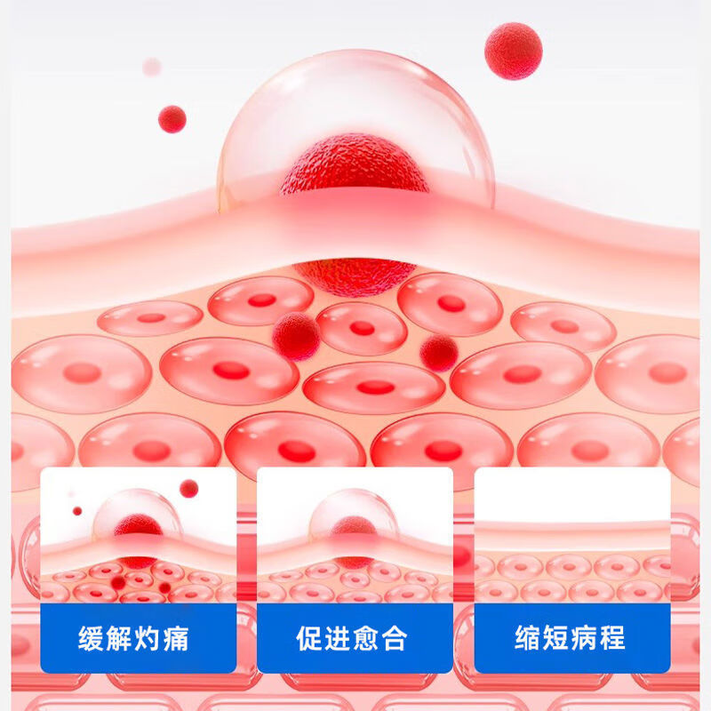 Parche de úlcera oral para niños de Haishi Hainuo La membrana de úlcera oral acorta el curso de la enfermedad y se pega a la úlcera oral para cubrir