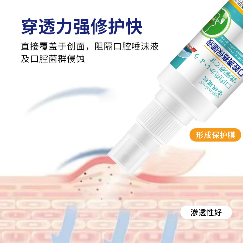 口腔上火保健液35ml口舌泡立て歯茎腫れ痛み口角不快口腔ケア液スプレー|undefined