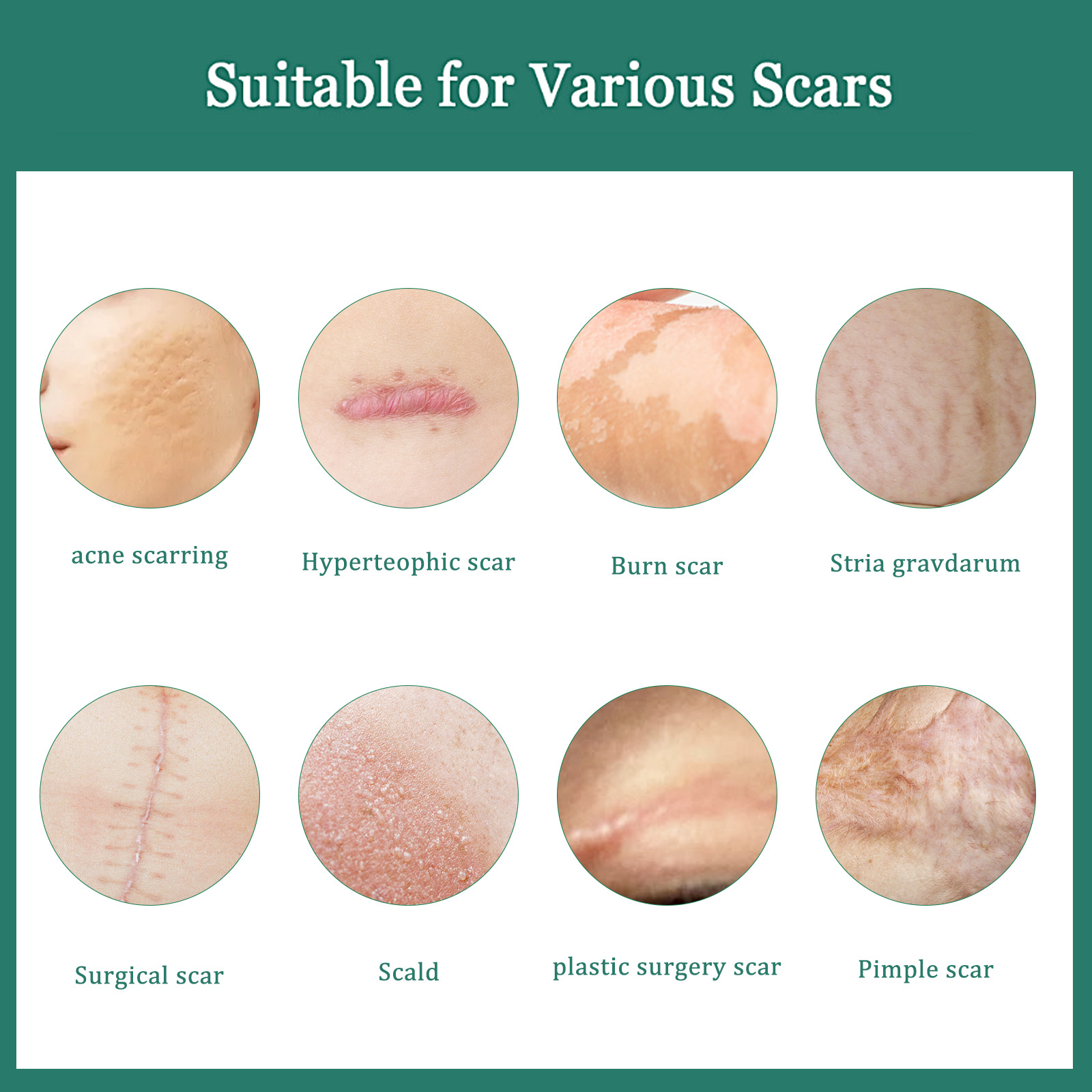 La crema reparadora y aclaradora de cicatrices EELHOE elimina cicatrices de quemaduras, cicatrices antiguas, cicatrices posoperatorias, crema reparadora y suavizante de la piel (paquete de 2)_voghion.com