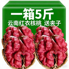 ��ϼtƤ����2025����؛ԭζ��Ƥ�ϼt�¼t��Ѫ�����ЋD�Թ�С��ʳ
