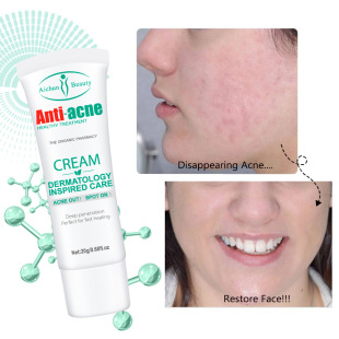 Aichun Cross-Border Salicylic Acid Cream Moisturizing, Brightening and Fine Pores Wholesale Acne Removal Cream