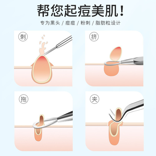 Factory direct supply acne needle set, blackhead removal tool, rose gold acne needle, acne needle, beauty needle 4-piece set