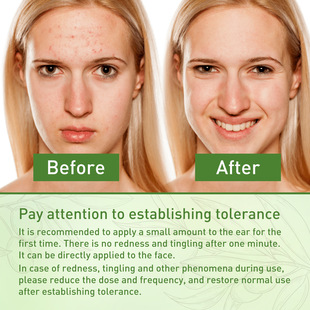 Jaysuing ���ϙ�������� Ę���Ͷ��غ��̝������o������Ę����ӡ