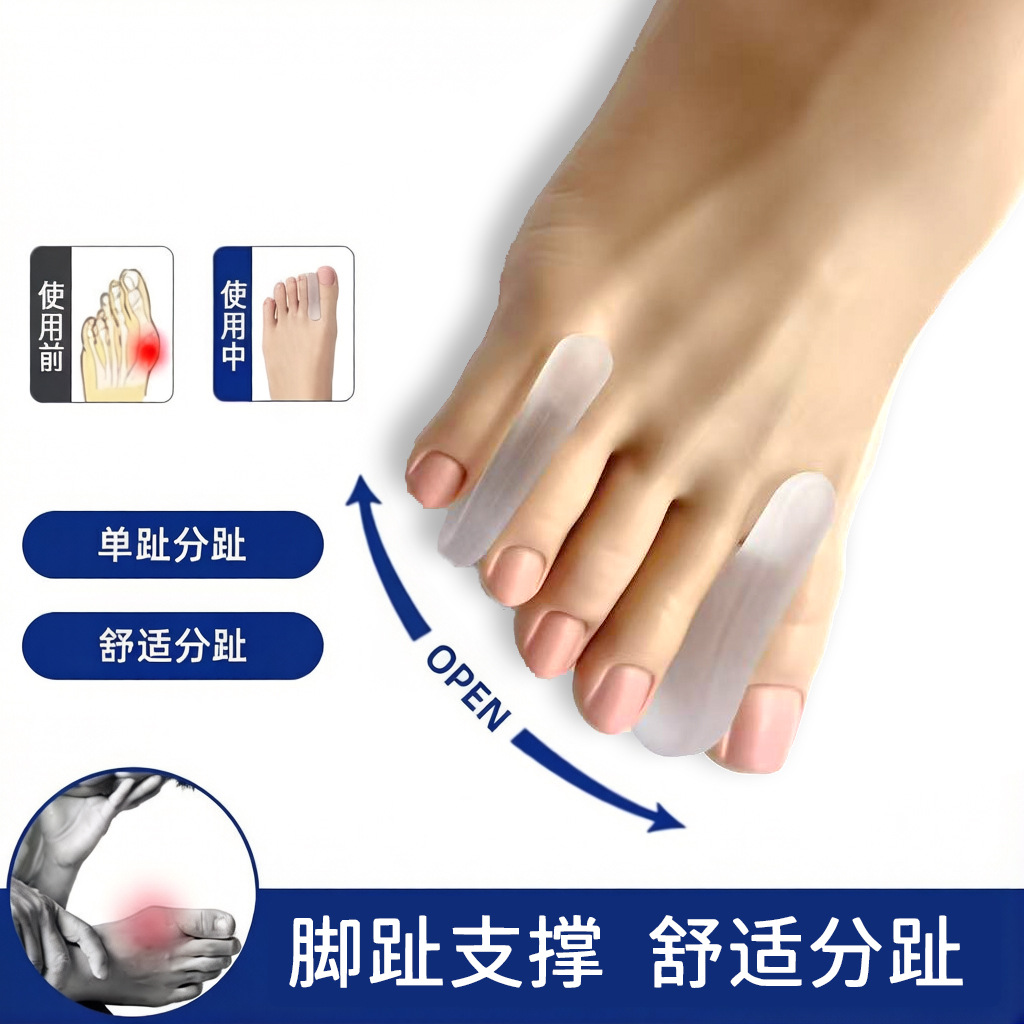 A-shaped toe separator to correct toe artifact, toe overlap separator, large foot bone toe valgus, toe clip orthosis