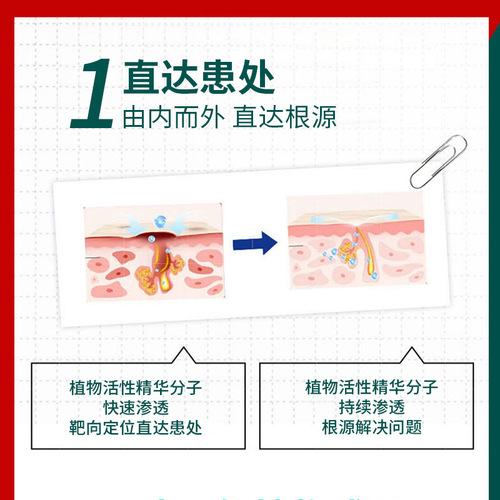 Shunaimeimi Tianfu bio-antibacterial cream herbal anti-itch cream Miao medicine hand, foot, thigh root itching ringworm itching cream wholesale