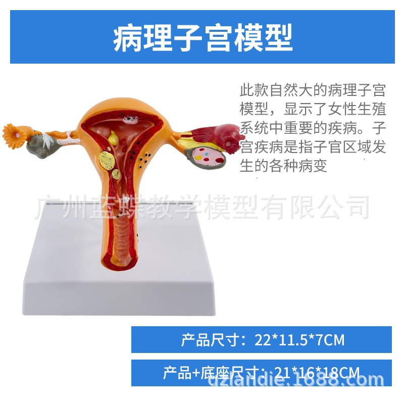 Ů����ֳģ��ģ��Ů����ֳģ��ģ��˽���ӹ�ģ�ͽ̾߸����ѳ�����