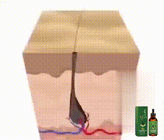 South Moon Ginger Hair Thickness Essential Oil reparerar torrt, skadat hår, förhindrar håravfall och stärker håret._voghion.com