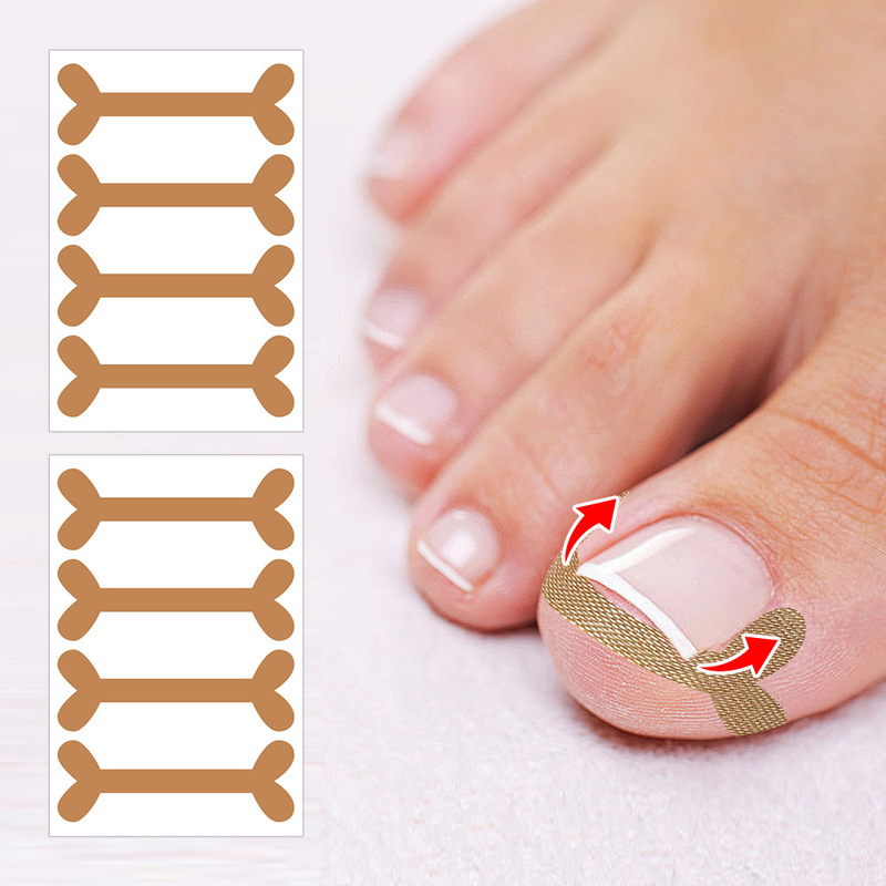 Cross-Border Dropshipping Self-Adhesive Elastic Toenail Correction Patch Nail Repair Ingrown Nail Patch Nail Groove Correction Buckle Corrector