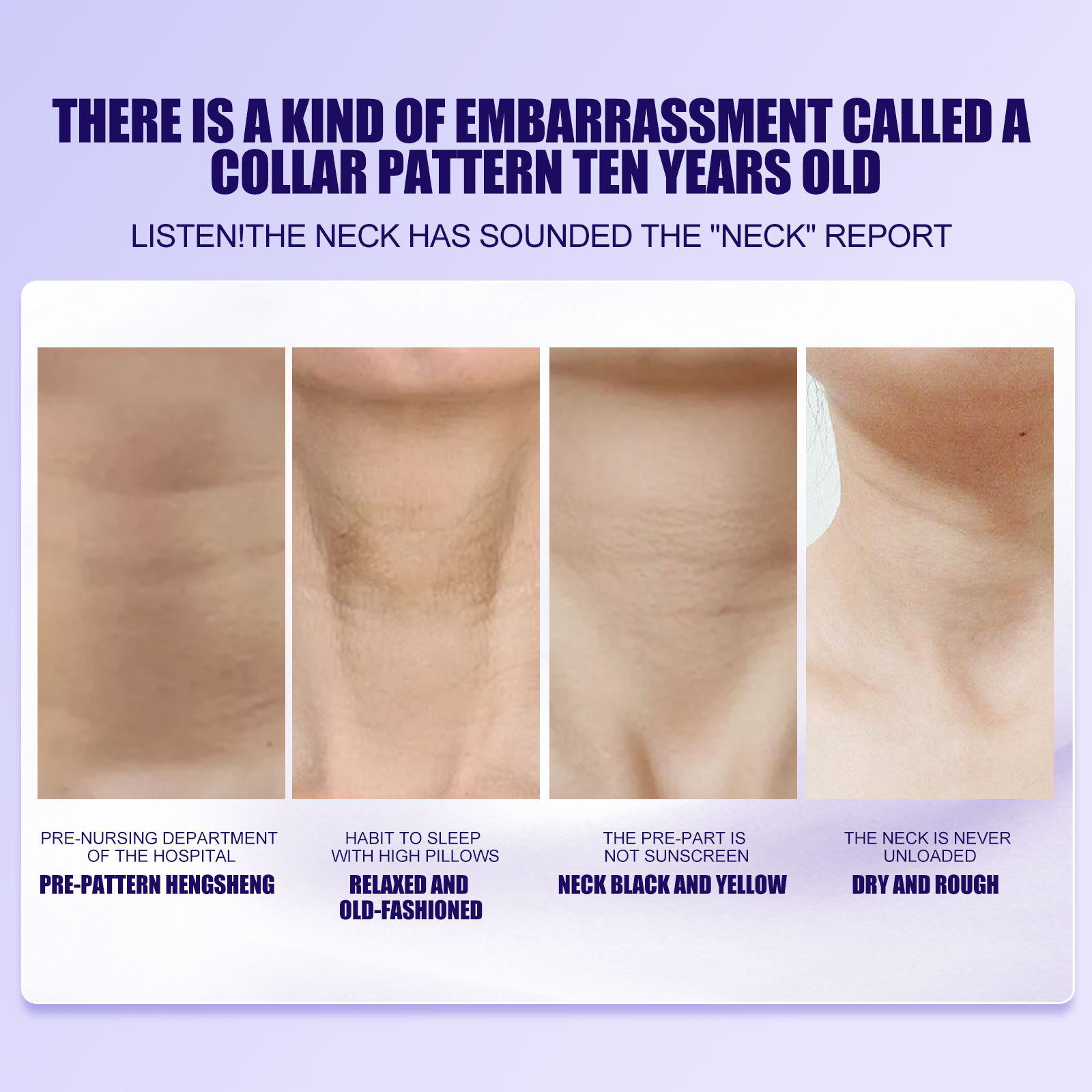 L'olio di serpente EELHOE schiarisce leviga le rughe Crema per il collo liftante, rassodante, levigante, sbiancante e idratante_voghion.com