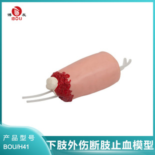 ������֫�����ֹ֫Ѫģ��ֹѪӖ����֫ģ�߼���̎��ʾ����ģ�M��