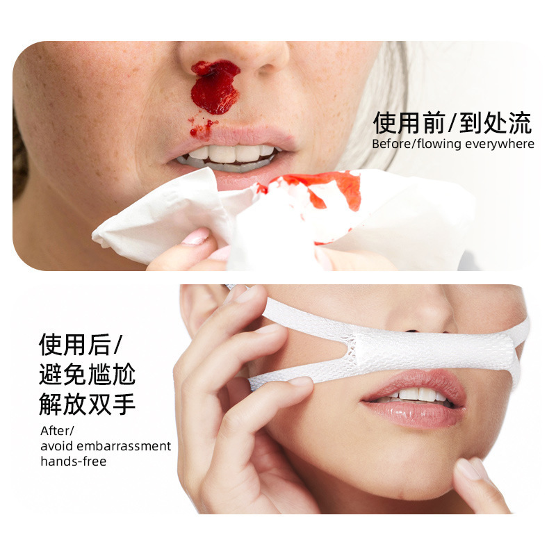 Amazonで最も売れているコットンボール鼻包帯、鼻パッド、ストレッチリバウンドメッシュ弾性耳掛け包帯|undefined