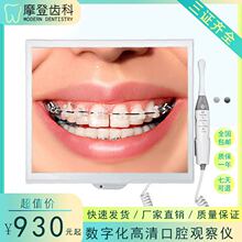 口腔内窥镜高清数字化口腔观察仪一体机微距超清摄像多屏显示