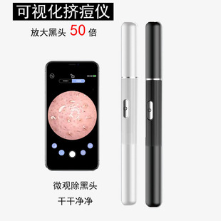 50X Magnifying Blackhead Extractor for Facial Cleansing, Blackhead and Acne Removal Needle, Beauty Instrument for Deep Acne Removal