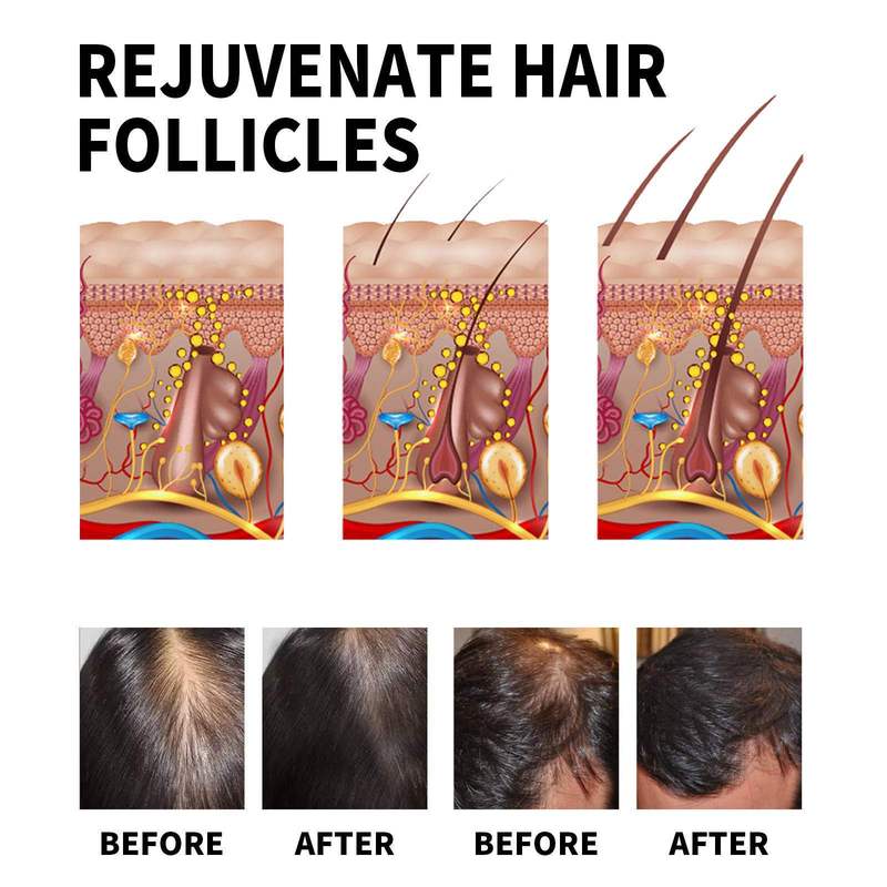 Jaysuing 頭皮濃密ヘアオイルエッセンス育毛マッサージ頭皮ヘアオイルは髪を強化し、髪を濃密にします|undefined