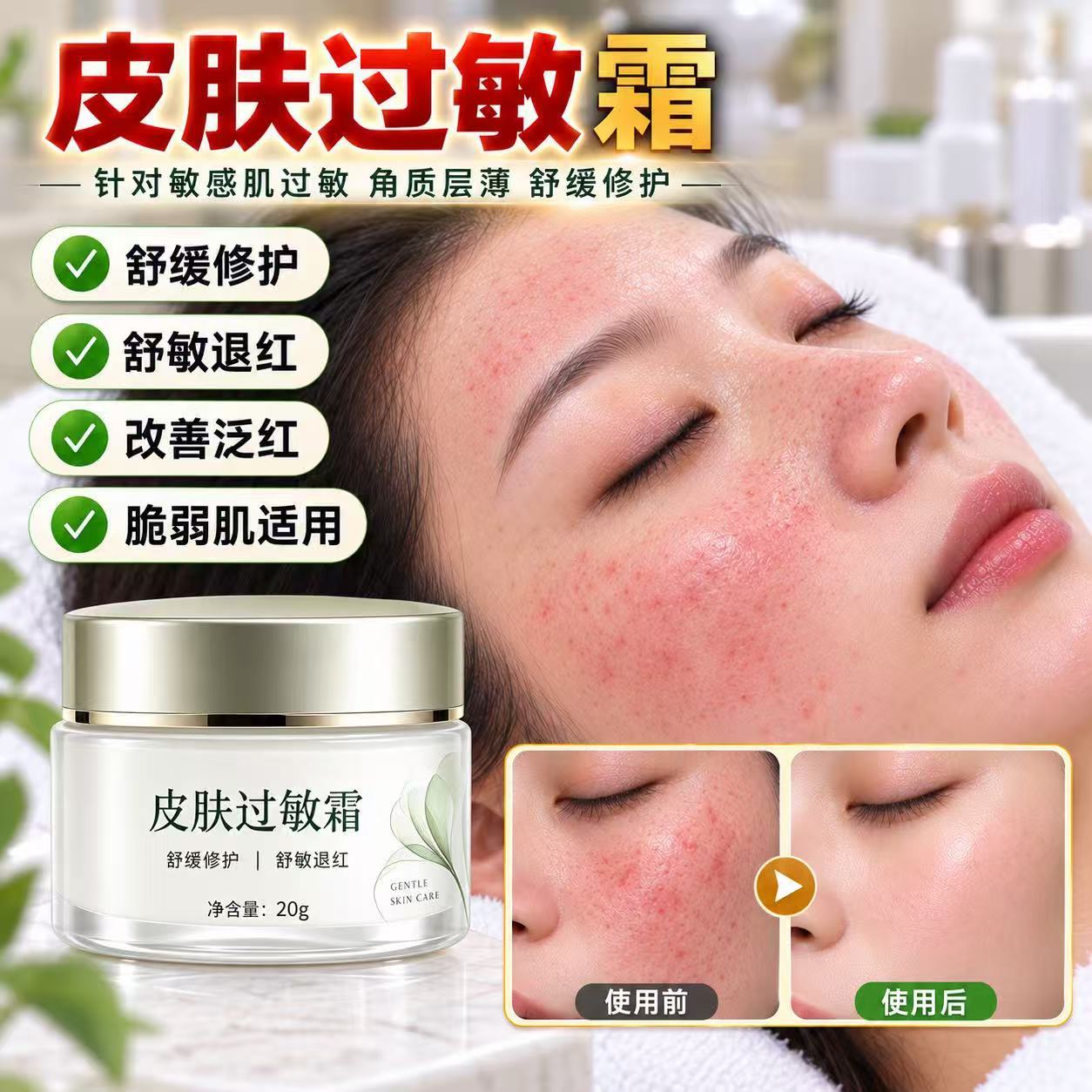 术后厚脸皮舒缓退红霜增厚角质层激素脸修护霜斑后烂脸多肽急救霜