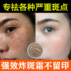 美白祛斑霜炸斑霜强效去黑色素断黑去黄褐斑雀斑老年斑美容院专用