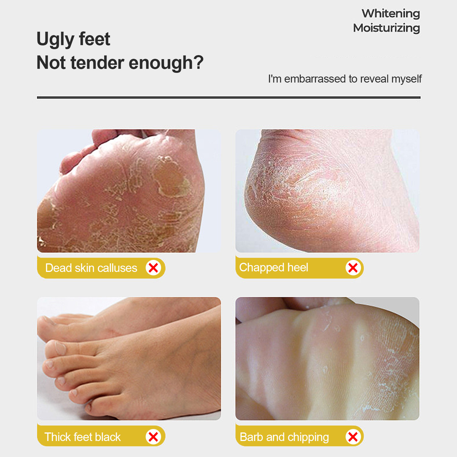 EELHOE Masaj Peeling Bakım Nemlendirici Kuru Çatlama, Soyulma ve Çatlama Karşıtı Ayak Koruma Kremi_voghion.com