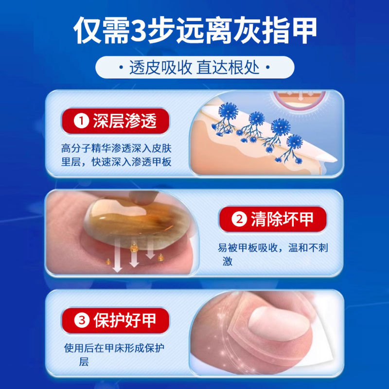 藤瀬製薬灰爪亮甲空甲溝直営足裏専用スプレー灰爪液軟甲ペースト亮甲|undefined