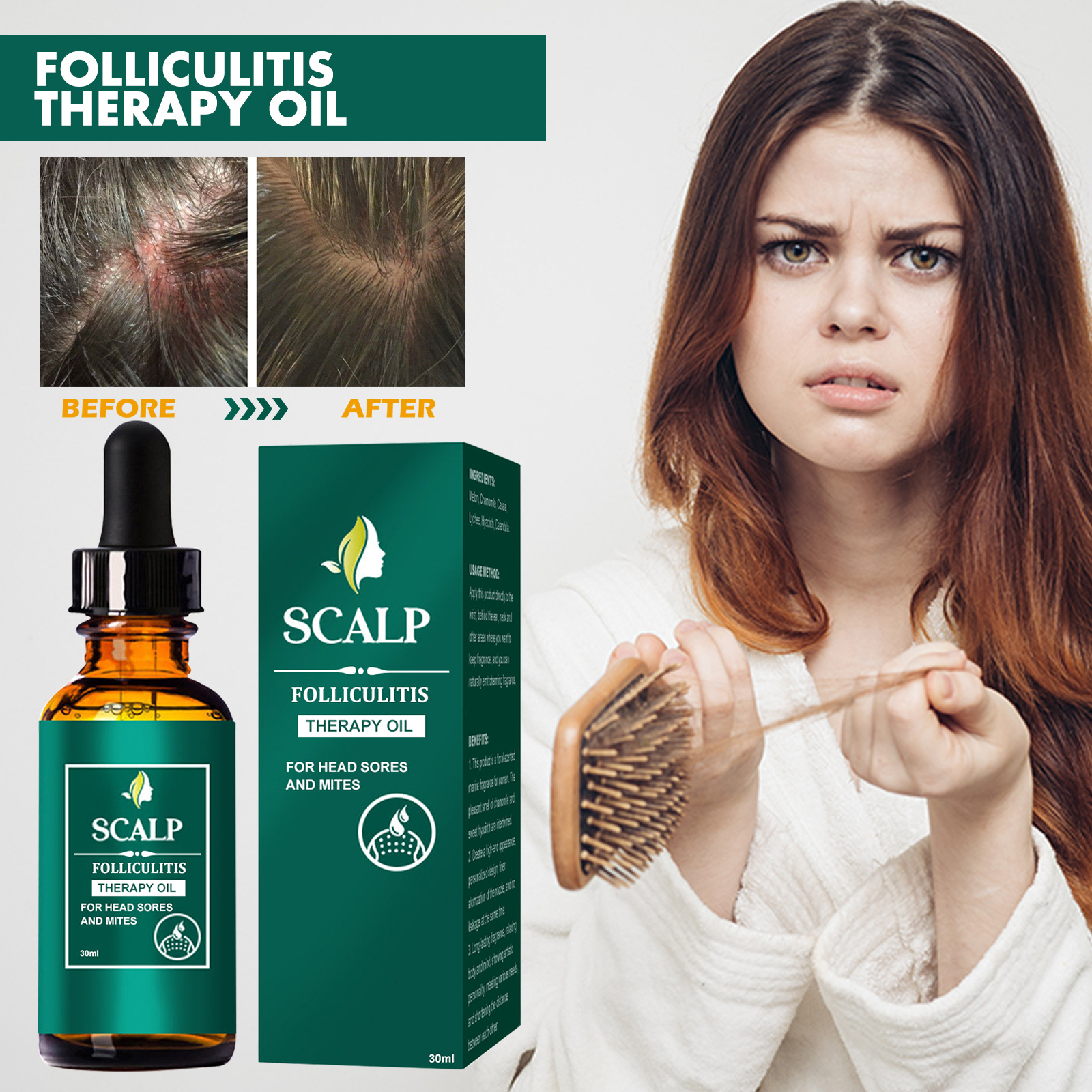 Olio essenziale EELHOE per la cura del cuoio capelluto e dei capelli, pulizia profonda del cuoio capelluto, riparazione delle radici dei capelli, antiprurito, prevenzione della caduta dei capelli e cura solida dei capelli_voghion.com