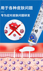 Stäng Niu Five Poison Snake Oil Itching Cream, Baicao Itching Cream, Herbal Antibacterial Cream, Skin External Use, Direct Factory Shipping