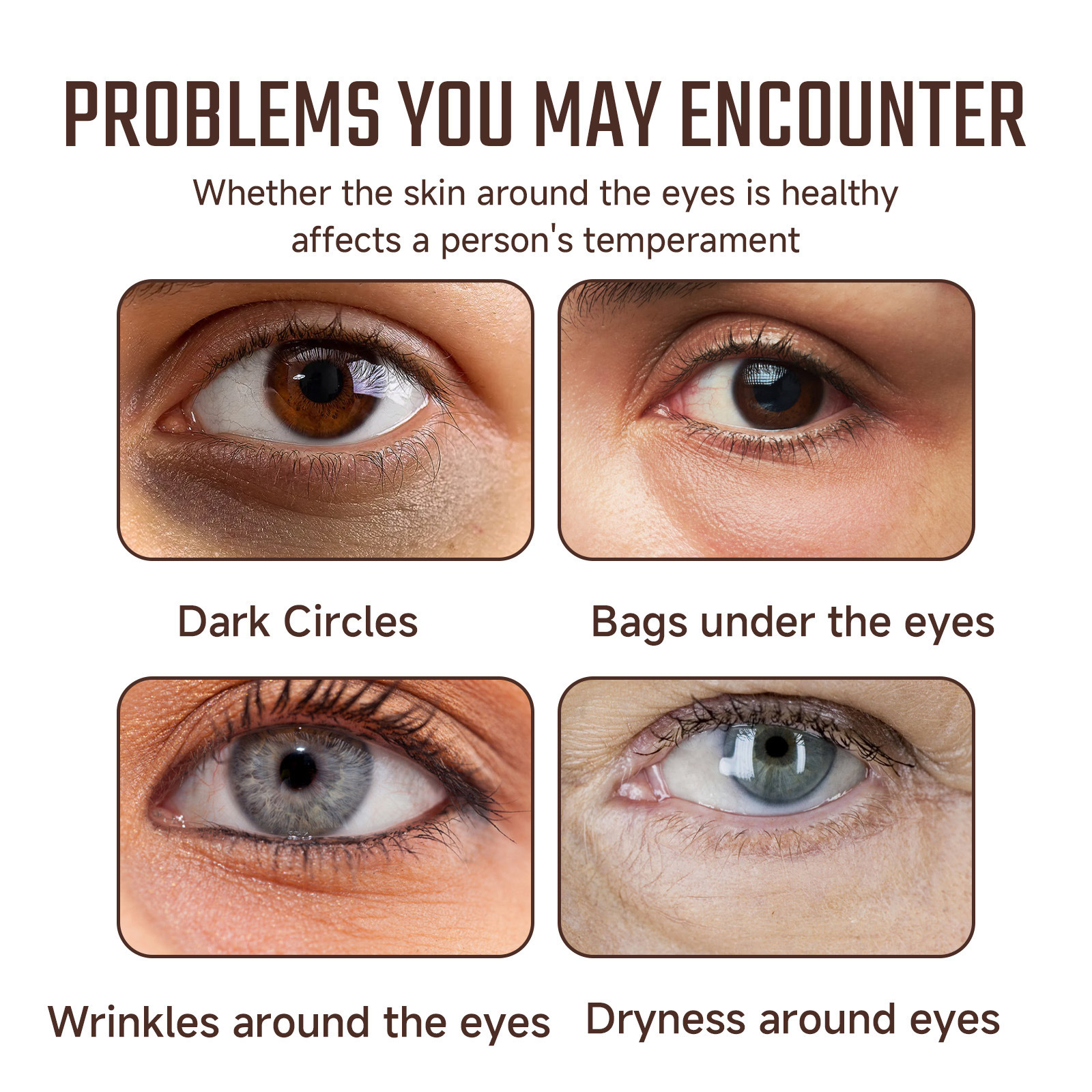 OUHOE 眼部精華 淡化眼部細紋黑眼圈補水保濕修護眼部肌膚精華液