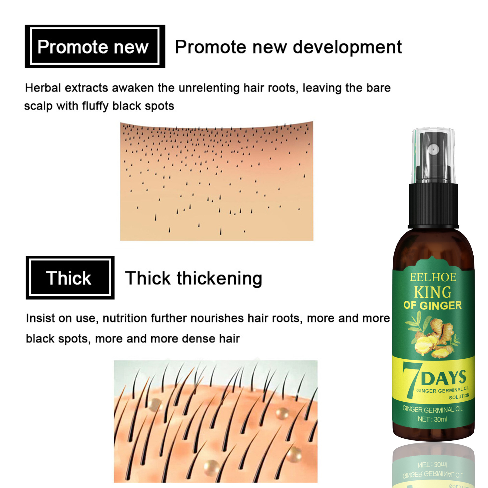 eelhoe ginger hair growth spray strengthens hair massage scalp dense hair solid hair anti-fall repair nourishing liquid_voghion.com