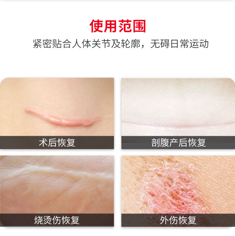 Silicone Gel Baby Ear Correction Patch Skin Tone Low Sensitivity Ear Shaping Tape for Protruding Ears 2 Rolls 2cm x 100cm quality and texture