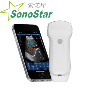 ���Z��Sonostar ���Q�����S��ֱ�N ��ꇜ\��ϵ�� �o������B��̽�^