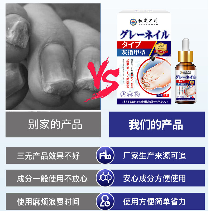 指甲外用保健液指甲不适发黄增厚萎缩温和抑菌灰指甲型护理液代发|undefined
