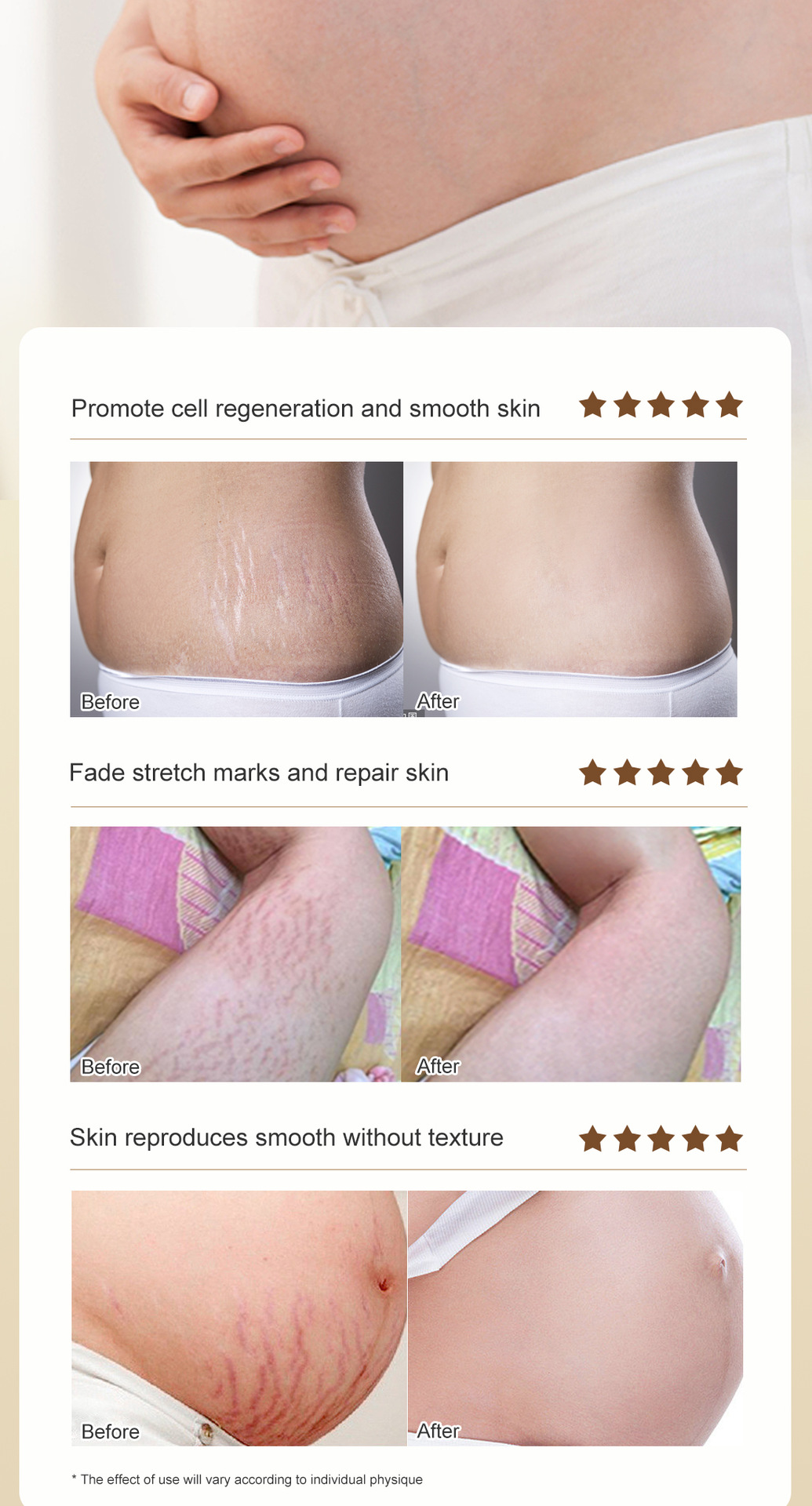 Rose Stretch Marks Cream Image 8