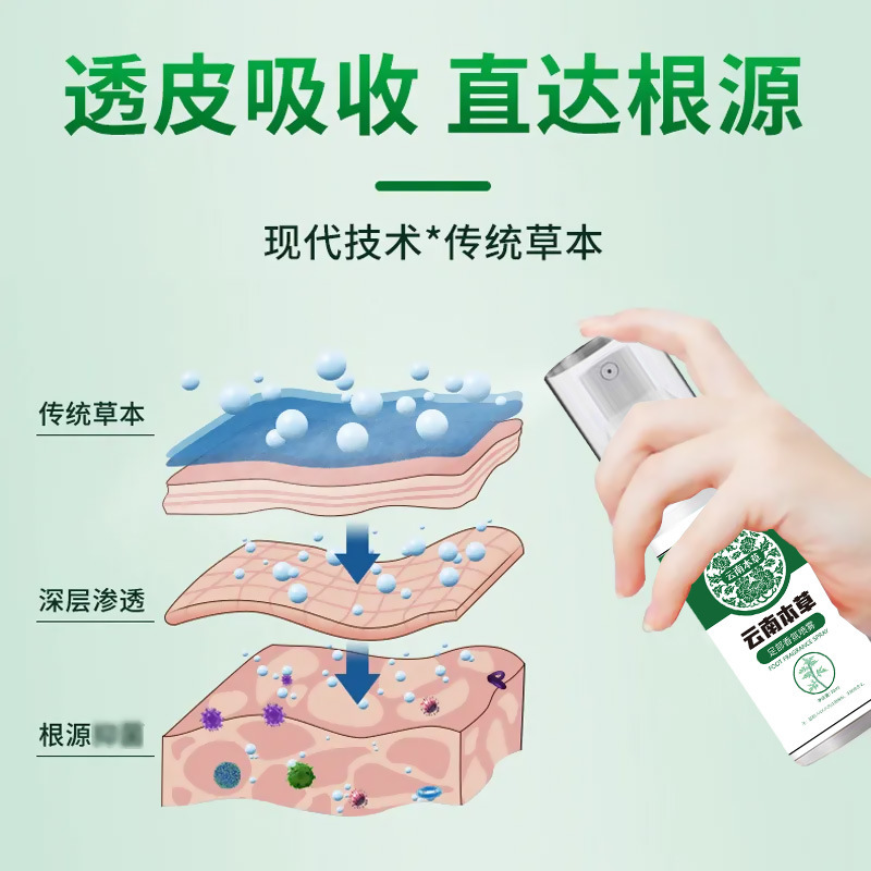 Lanxun フットフレグランススプレーは、足の臭い、足のピーリング、足の汗、水虫を除去します。雲南ハーブ抗かゆみスプレー|undefined