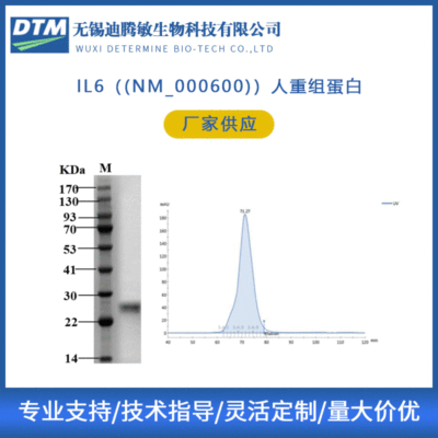 IL6（(NM_000600)）人重组蛋白 白细胞介素6重组蛋白 无锡迪腾敏