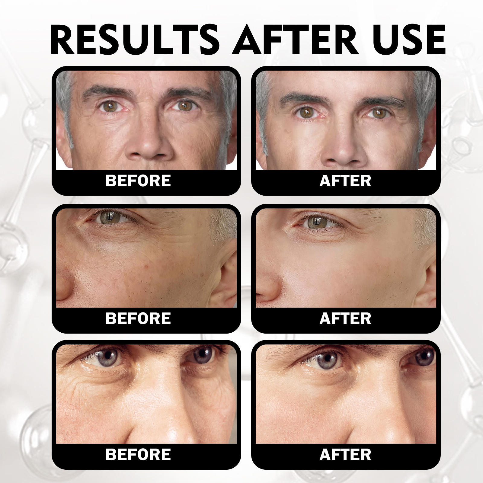 Anti-Aging Men's Moisturizing Cream for Reducing Fine Lines and Wrinkles_voghion.com