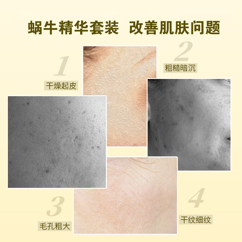 Youzhuang カタツムリエッセンススキンケア製品セット本物の水エマルジョン保湿クリーム保湿ミルク bb クリーム化粧品卸売|undefined