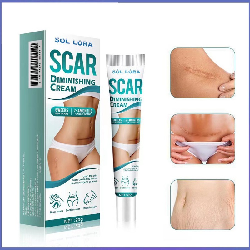Sol Lora Cross-Border Herbal Scar Lightening Gel for Acne Scars, Surgical Scars, Cesarean Section Scars, and Post-Pregnancy Care Cream Sol Lora Cross-Border Herbal Scar Lightening Gel for Acne Scars, Surgical Scars, Cesarean Section Scars, and Post-Pregnancy Care Cream